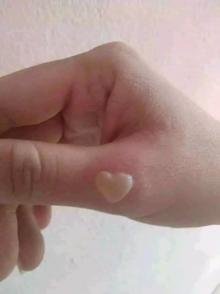 penampakan nyeleneh bagian tubuh manusia © berbagai sumber