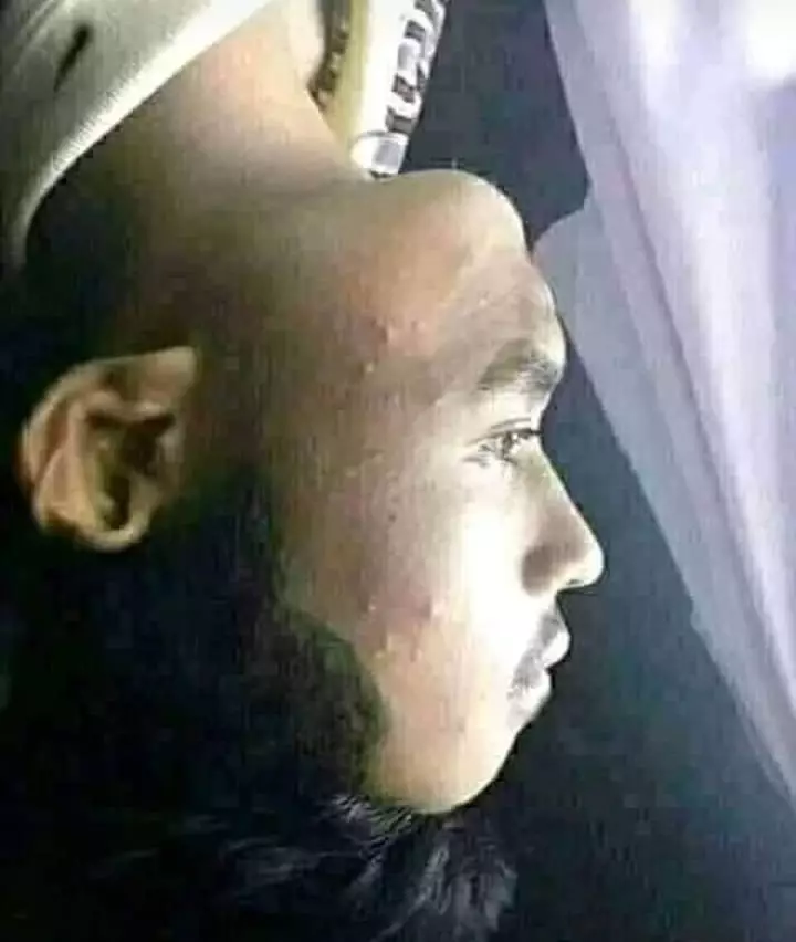 penampakan nyeleneh bagian tubuh manusia © berbagai sumber