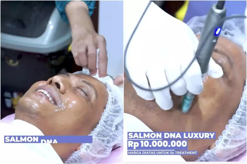 doddy sudrajat perawatan wajah © instagram doddy sudrajat perawatan wajah © instagram