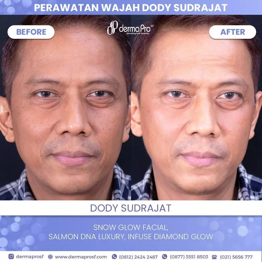 doddy sudrajat perawatan wajah © instagram doddy sudrajat perawatan wajah © instagram