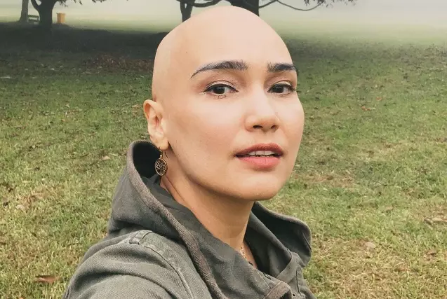 Pernah terkena kanker, ini gaya hidup sehat 7 artis yang inspiratif berbagai sumber