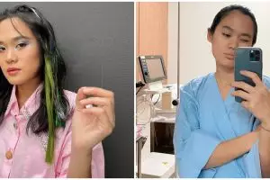  Alami saraf terjepit, Sheryl Sheinafia ceritakan kronologinya