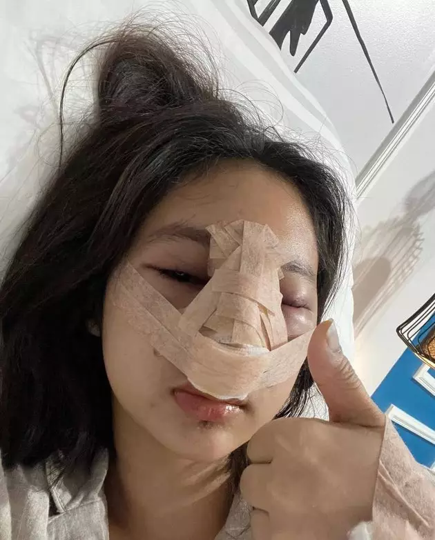 putri Farida Nurhan setelah oplas © Instagram