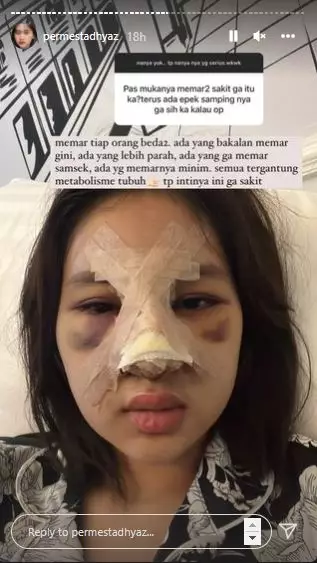 putri Farida Nurhan setelah oplas © Instagram