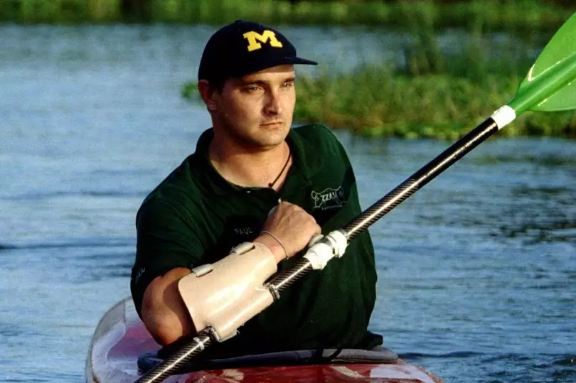 Kisah pria kehilangan tangan karena diserang kuda nil Berbagai sumber