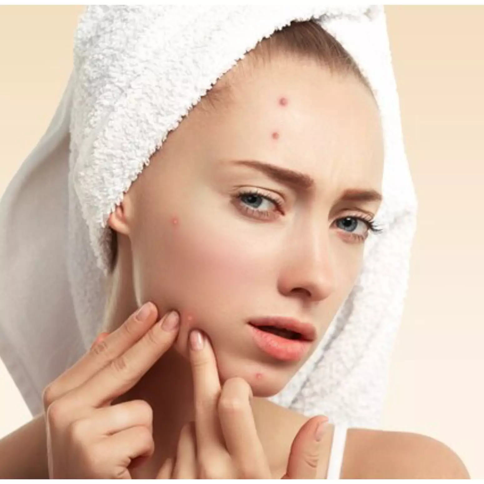 9 Kandungan skincare untuk kulit berjerawat, wajib dicoba