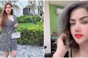 Habiskan Rp 50 juta, 11 potret Barbie Kumalasari usai operasi hidung