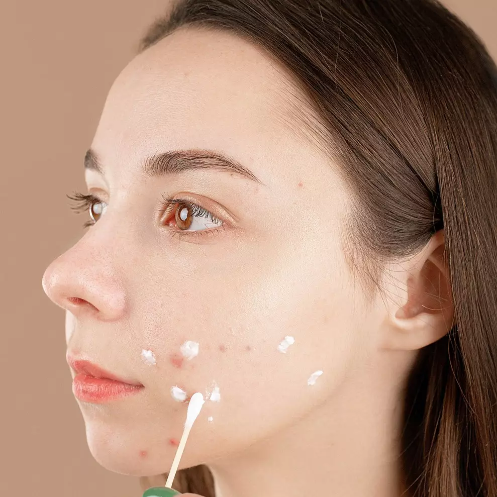 9 Tips hilangkan wajah bopeng, kulit kembali mulus