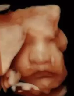 USG bayi Nadine Chandrawinata © Instagram