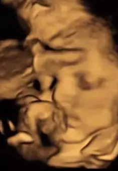 USG bayi Nadine Chandrawinata © Instagram