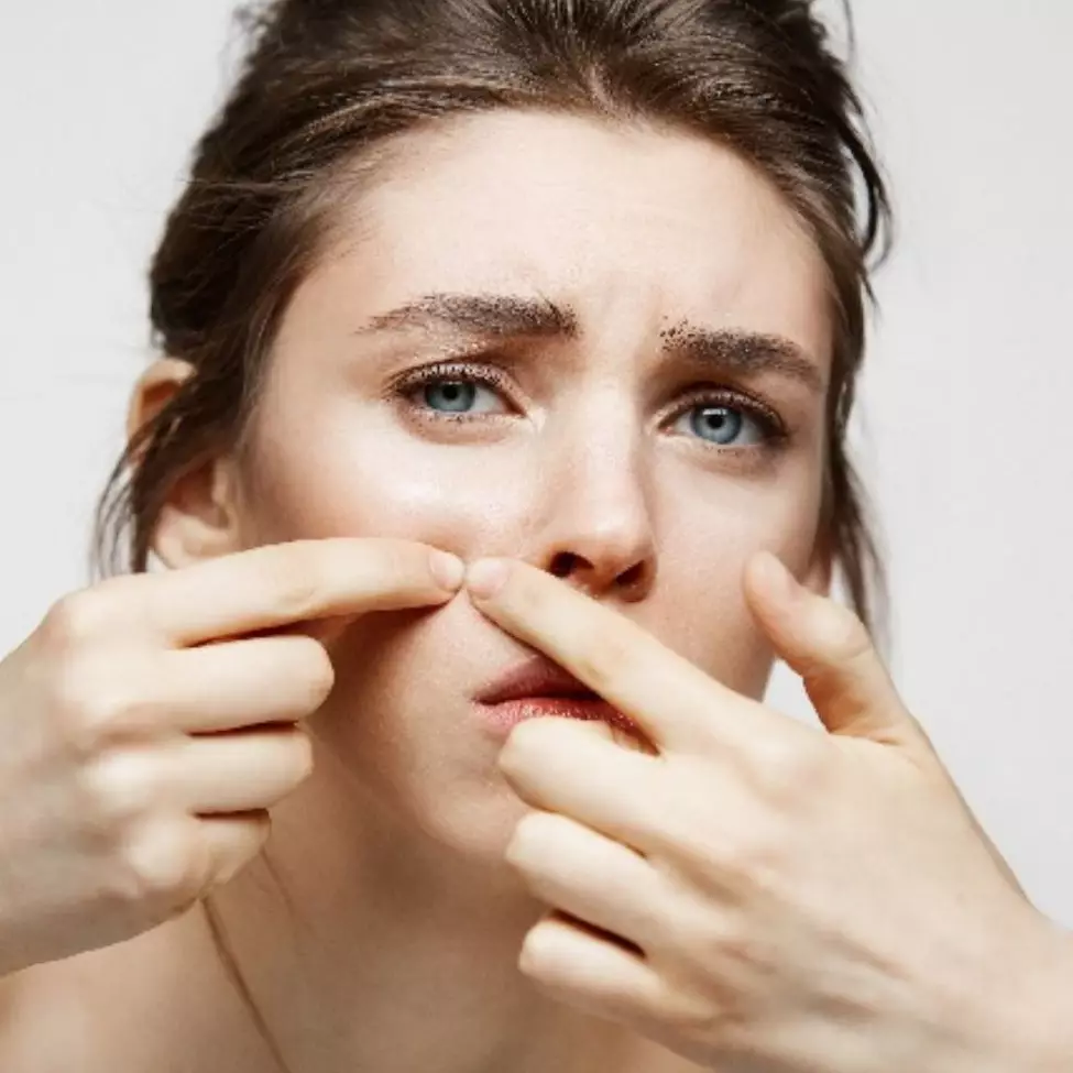 9 Manfaat niacinamide untuk wajah, membantu menyamarkan noda hitam