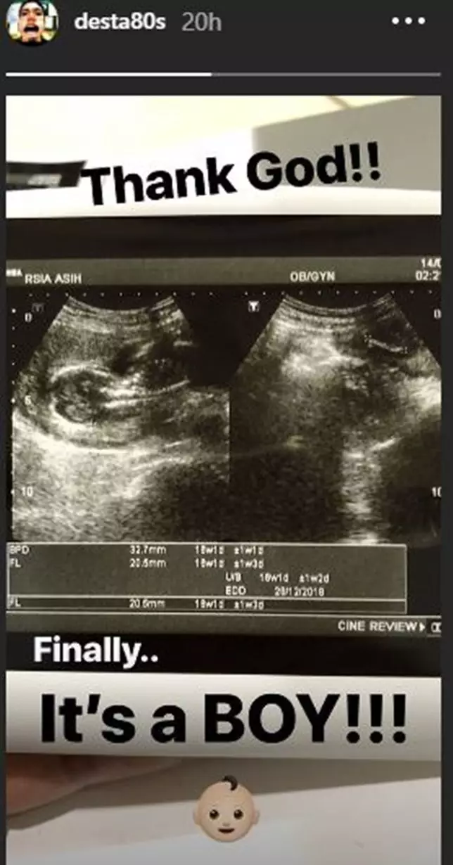 Momen gender reveal istri presenter © berbagai sumber