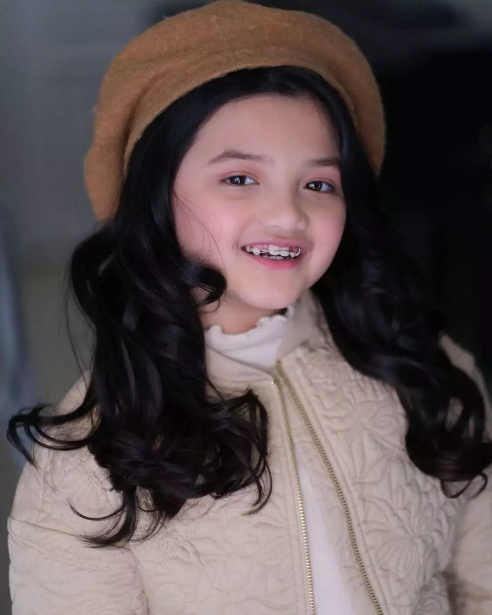 Momen Arsy pasang behel YouTube dan Instagram