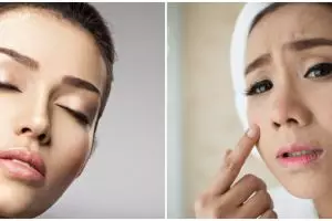 Rekomendasi 11 skincare untuk kulit kering, harga di bawah Rp 100 ribu