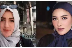 11 Transformasi crazy rich Shandy Purnamasari, makin flawless