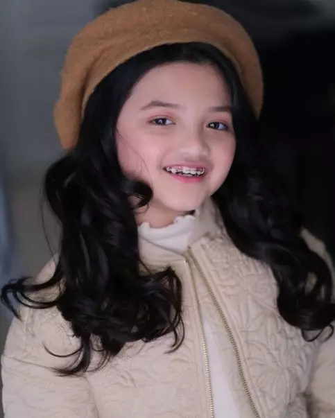 potret terbaru Arsy Hermansyah usai behel © Instagram