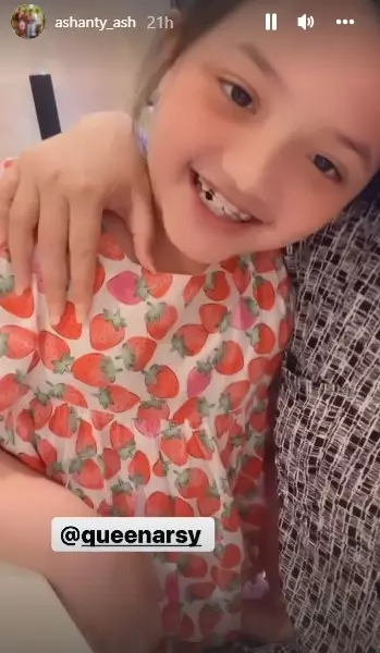 potret terbaru Arsy Hermansyah usai behel © Instagram