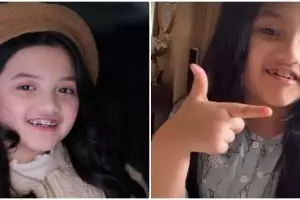 Pasang kawat gigi, ini 7 potret terbaru Arsy Hermansyah