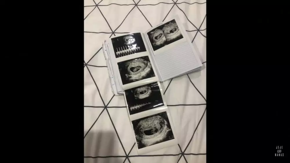 seleb umumkan kehamilan pakai cara unik © berbagai sumber