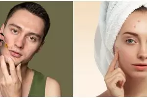 9 Serum lokal untuk kulit berjerawat, harga terjangkau