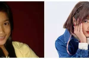 11 Potret jadul Fuji, pernah jerawatan parah dan pasang behel