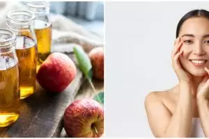 13 Manfaat cuka apel untuk wajah, atasi masalah jerawat