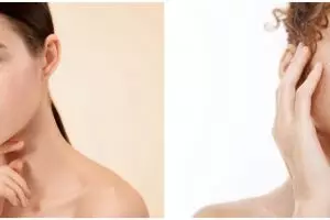 9 Penyebab flek hitam di wajah dan cara mengatasinya