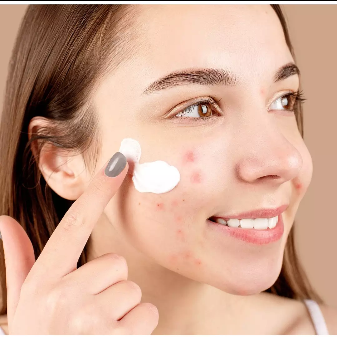 5 Cara menghilangkan merkuri di wajah, kulit kembali sehat