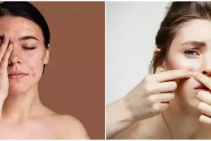 15 Produk skincare untuk kulit berjerawat, harga di bawah Rp 150 ribu