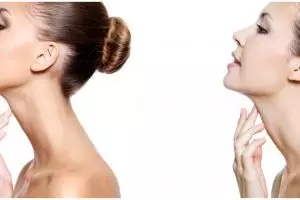 7 Manfaat Aish Serum Neck Brightening, cerahkan area leher