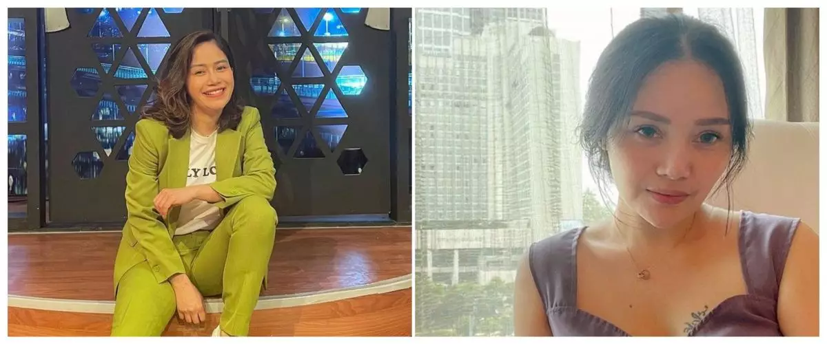 Transformasi 9 seleb setelah operasi plastik, Mawar AFI bikin pangling