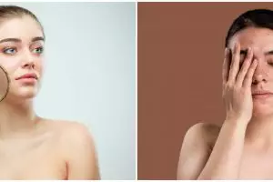 7 Manfaat serum Nutrishe Intensive Bright & Glow, melembapkan kulit