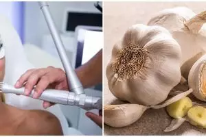 11 Cara menghilangkan kutil di wajah, pakai bahan alami dan teknologi