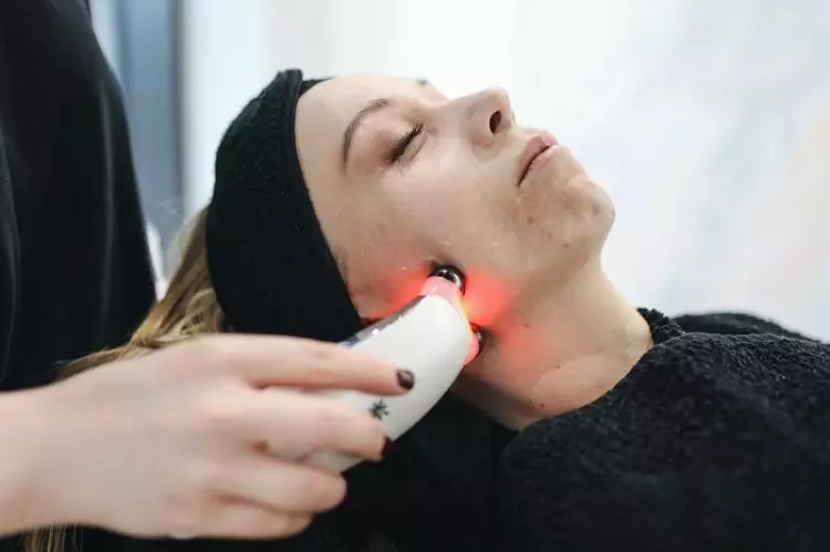 5 Manfaat picosure laser, bisa menstimulasi produksi kolagen