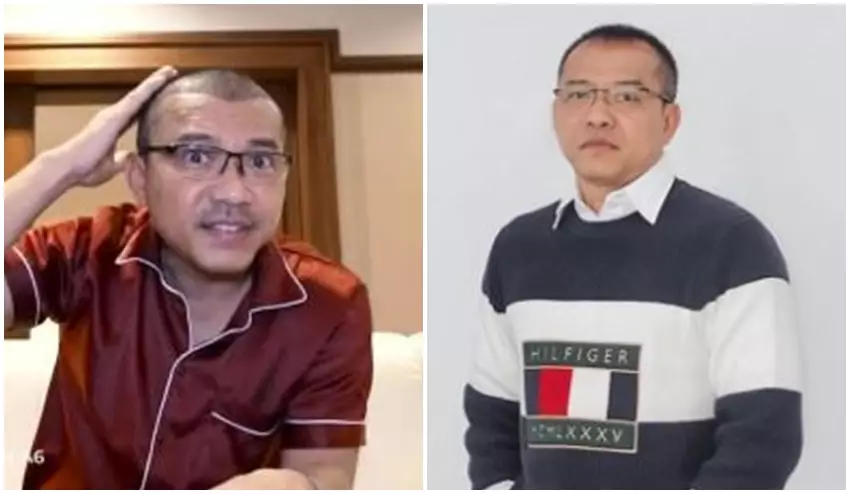 Anang Hermansyah sebelum dan sesudah transplantasi rambut © Instagram