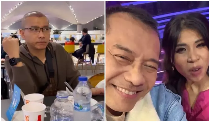 Anang Hermansyah sebelum dan sesudah transplantasi rambut © Instagram