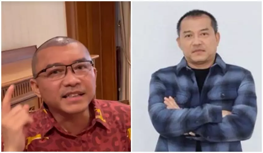 Anang Hermansyah sebelum dan sesudah transplantasi rambut © Instagram
