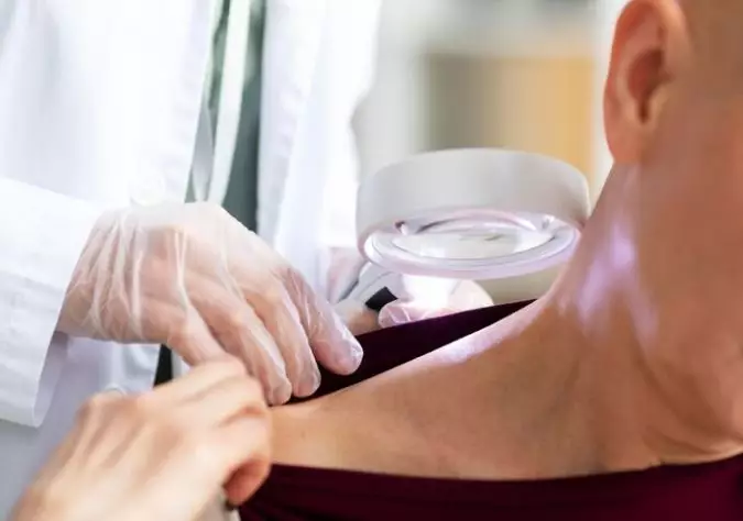 Ulkus dekubitus adalah luka pada kulit  © 2022 berbagai sumber 