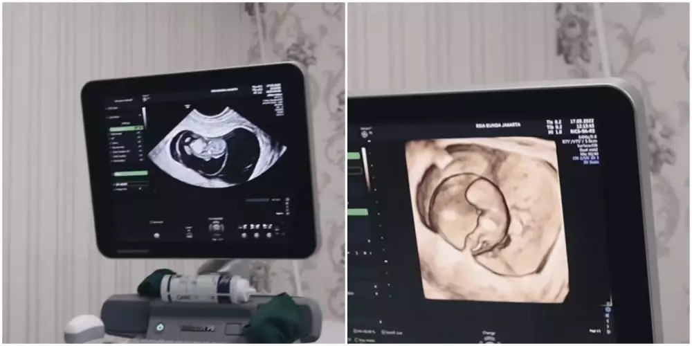 asmirandah keguguran © Instagram