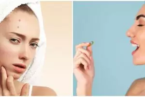 9 Penyebab breakout di wajah dan cara mengatasinya