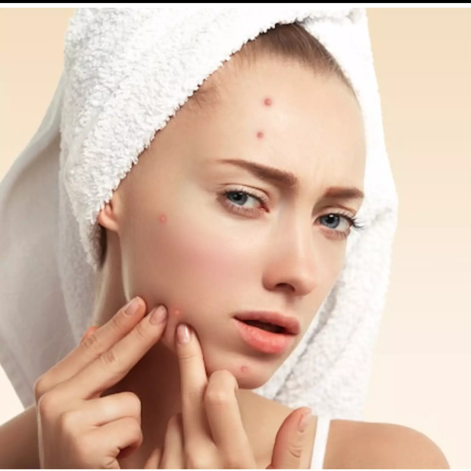 9 Penyebab breakout di wajah dan cara mengatasinya