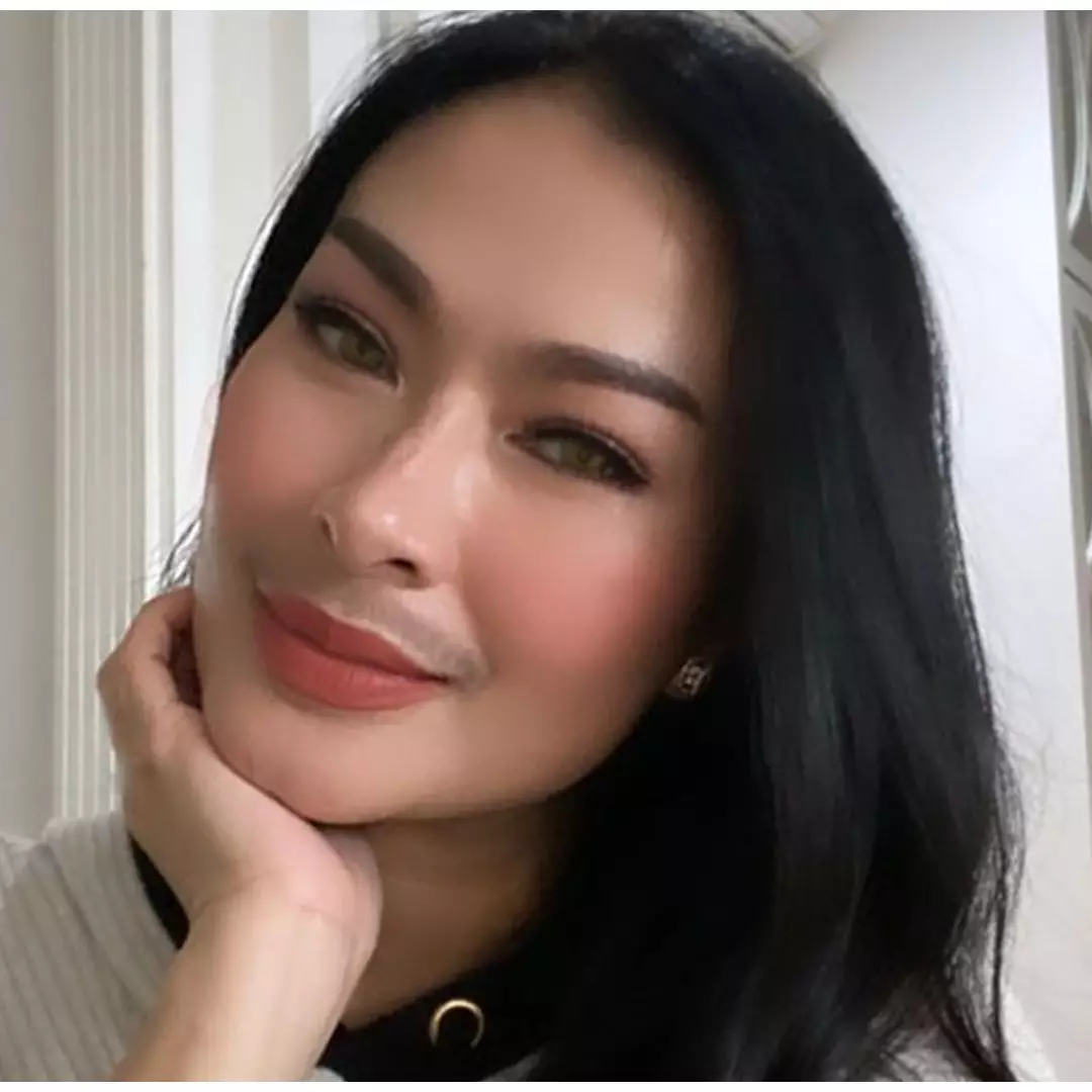 7 Perawatan kulit dan wajah Iis Dahlia, lakukan tanam benang