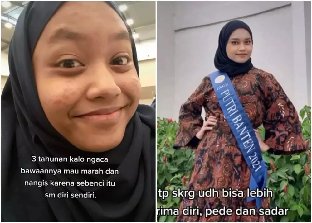 wanita glow up setelah diselingkuhi © Instagram