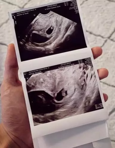 Dinda Hauw alami keguguran © Instagram Dinda Hauw alami keguguran © Instagram