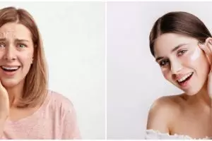 11 Penyebab kulit wajah kering dan cara mengatasinya