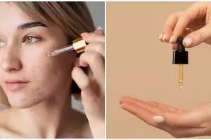 Rekomendasi 11 serum kulit berminyak & berjerawat mulai Rp 30 ribuan