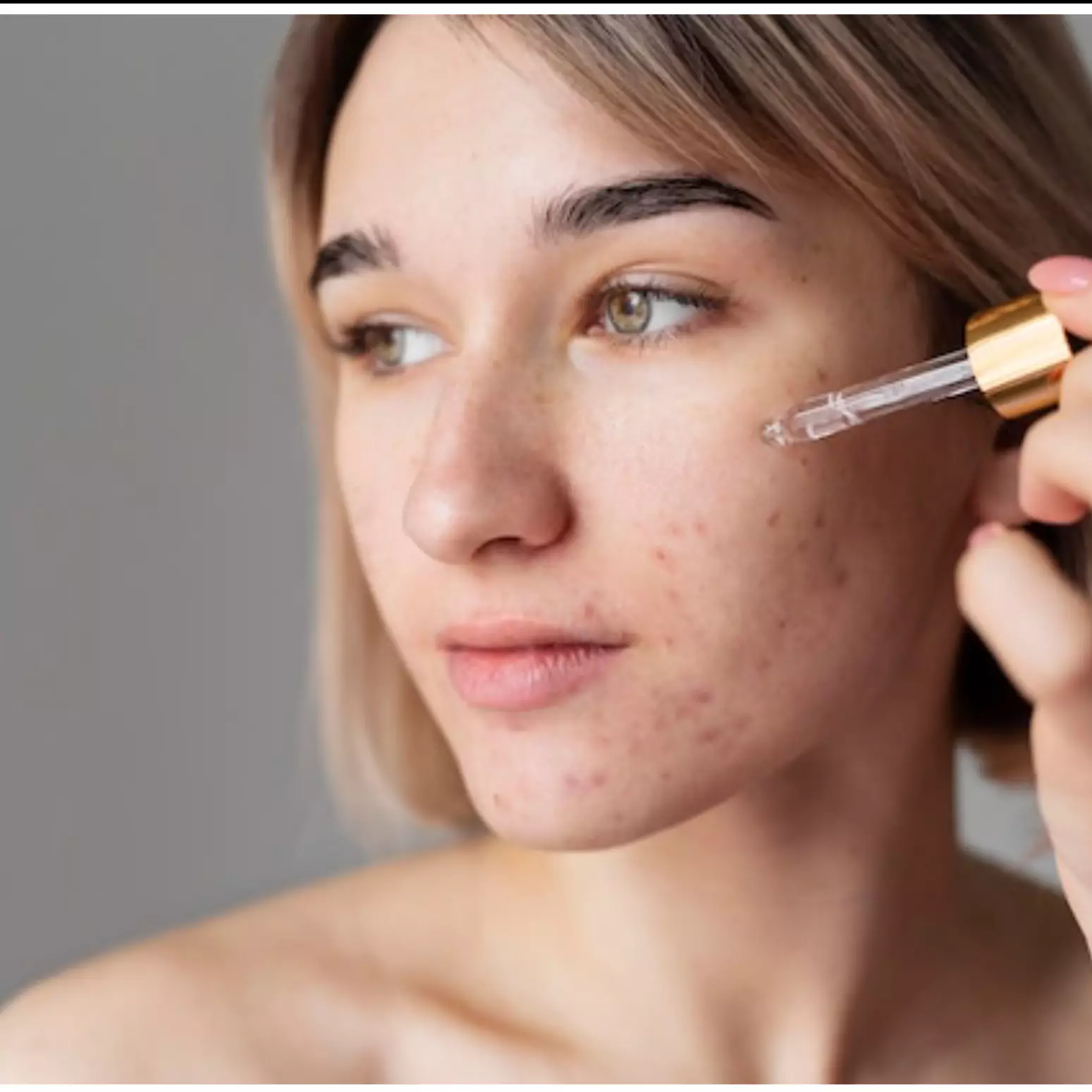 Rekomendasi 11 serum kulit berminyak &amp; berjerawat mulai Rp 30 ribuan