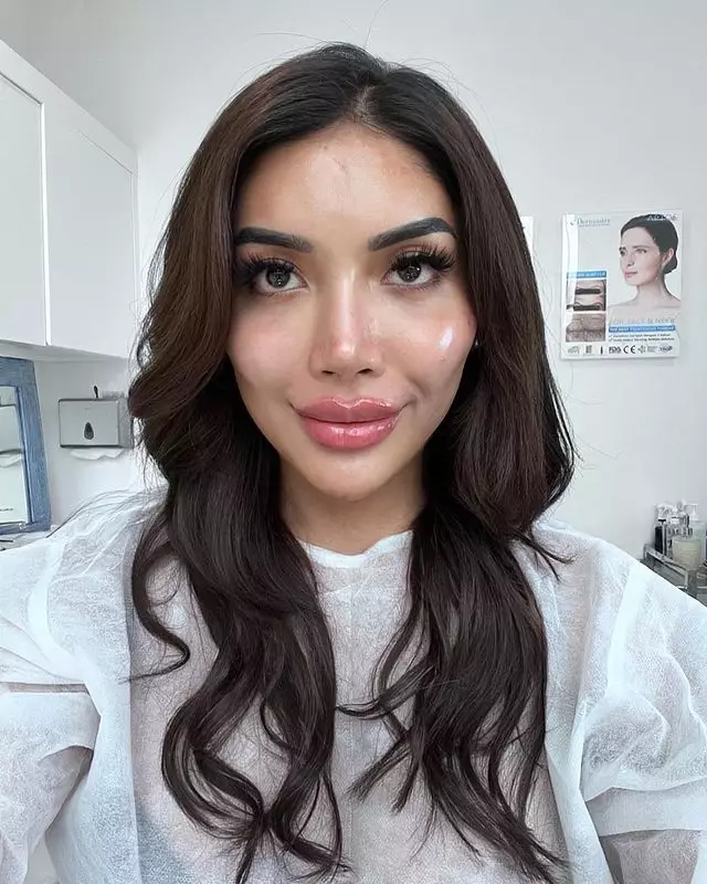 Transformasi Millen Cyrus © Instagram