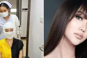 Momen Lucinta Luna operasi wajah, potret terbarunya bikin penasaran