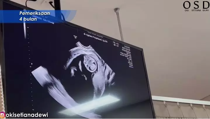 momen ria ricis cek kandungan © YouTube